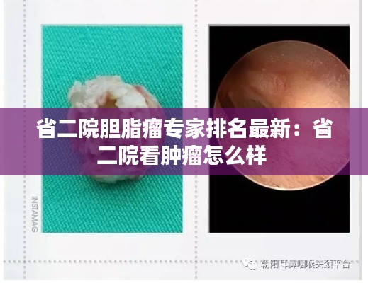 省二院胆脂瘤专家排名最新：省二院看肿瘤怎么样 