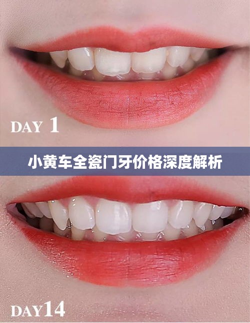 小黄车全瓷门牙价格深度解析