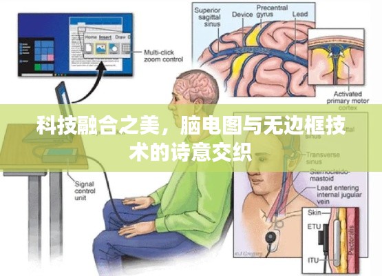 科技融合之美,脑电图与无边框技术的诗意交织