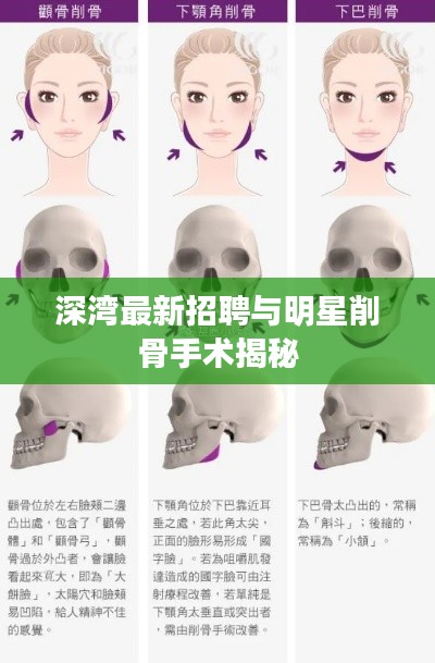 深湾最新招聘与明星削骨手术揭秘