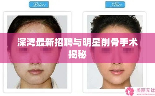 深湾最新招聘与明星削骨手术揭秘
