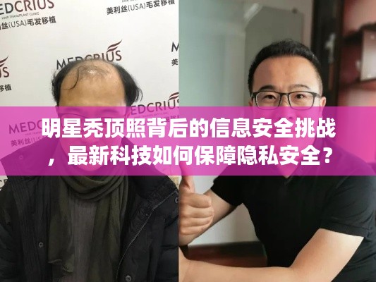 明星秃顶照背后的信息安全挑战,最新科技如何保障隐私安全?
