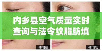内乡县空气质量实时查询与法令纹脂肪填充价格探讨,美容新知分享