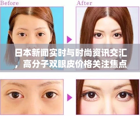 日本新闻实时与时尚资讯交汇,高分子双眼皮价格关注焦点