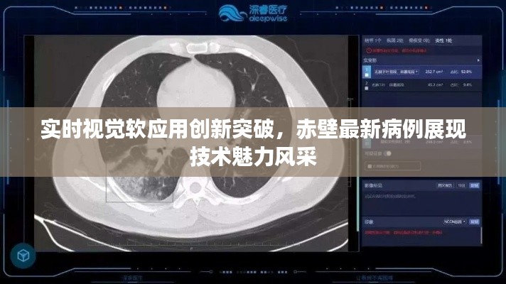 实时视觉软应用创新突破,赤壁最新病例展现技术魅力风采